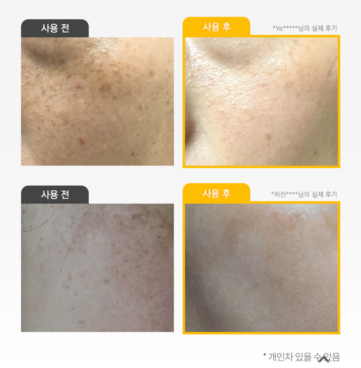 <<PRE ORDER>>VARI HOPE 8 Days Vitamin C Serum 공구구성 6/17/24-6/20/24